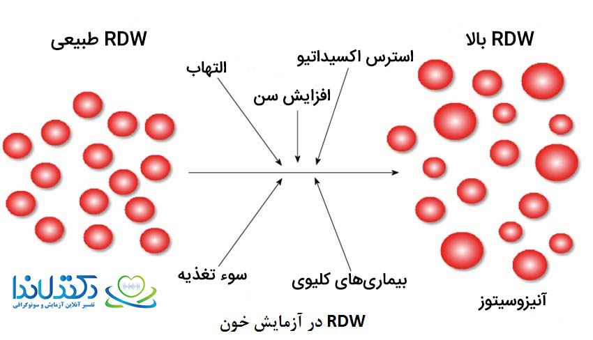 آزمایش RDW  چیست ؟